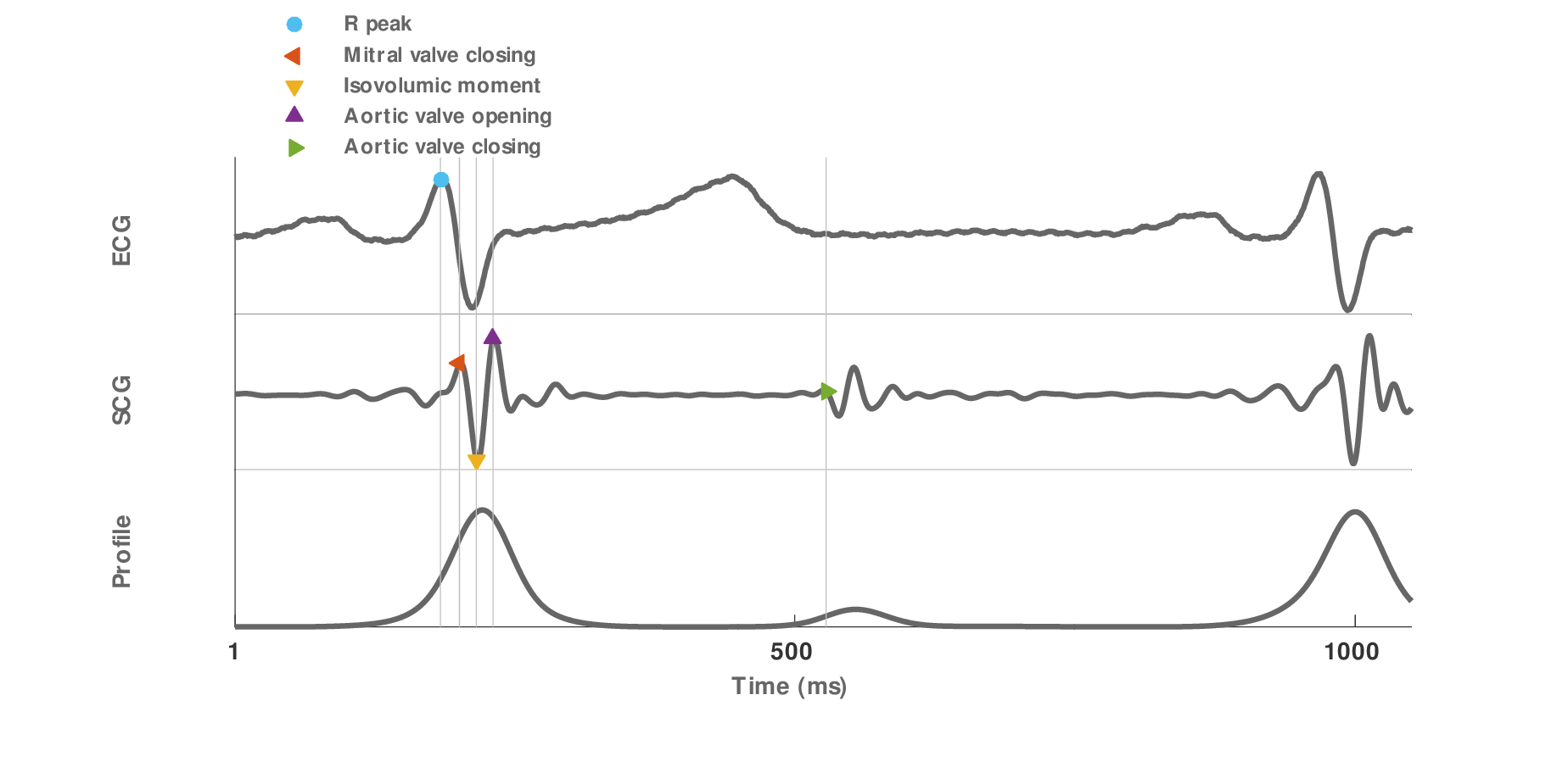 Ecg Diagram Explanation Choice Image - How To Guide And 