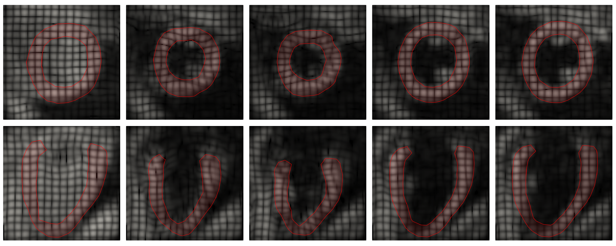 New paper with MSU and ETHZ on Mechanical Regularization for Medical Image  Registration – M3DISIM